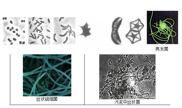 图1-7 特殊形态的细菌.png